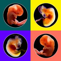 Forskjeller mellom et foster og nyfødt